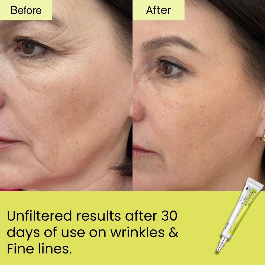 K Skin Glow Retinal Shot Tightening Booster