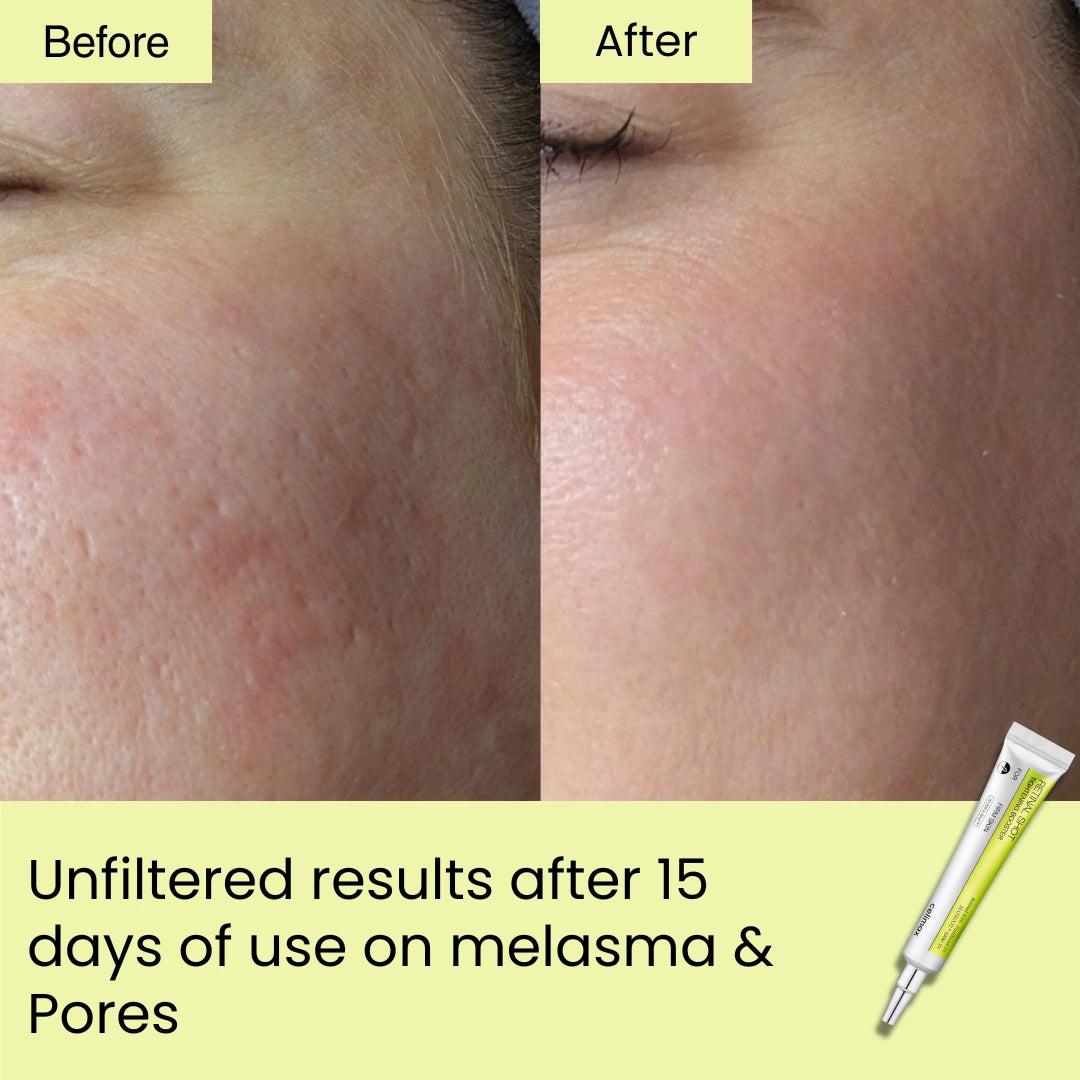 K Skin Glow Retinal Shot Tightening Booster