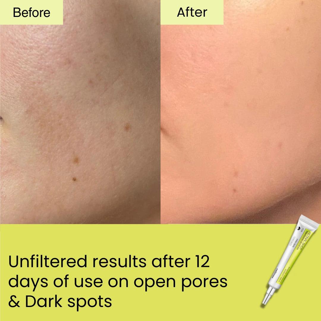 K Skin Glow Retinal Shot Tightening Booster